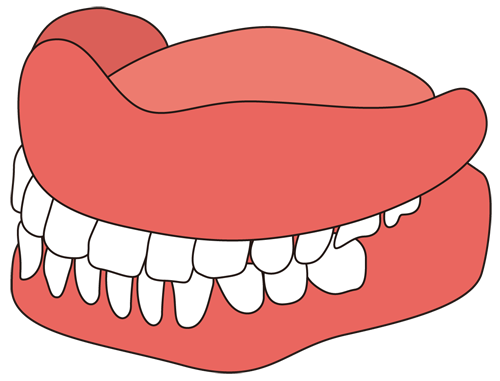 歯科模型（歯型）